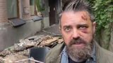 A director from the USA who arrived in Kiev to shoot a movie about the war fell along with the balcony